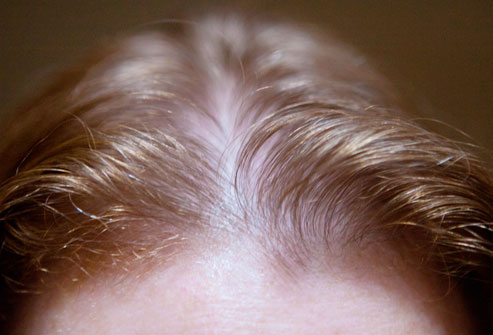 how to regrow hair guaranteed